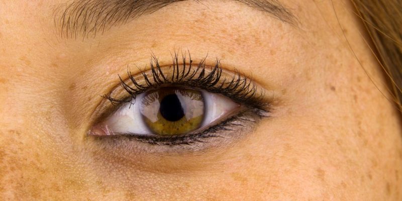 Freckles - are they only warm or can they be cool?