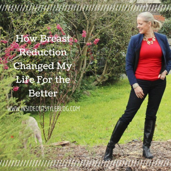 How breast reduction changed my life