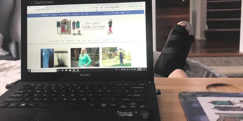 bunion surgery recovery 2 weeks Bunion surgery experience