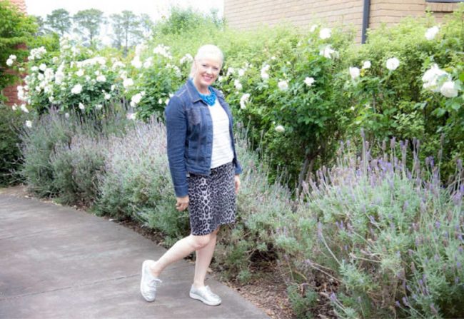 6 Weeks post bunion surgery update