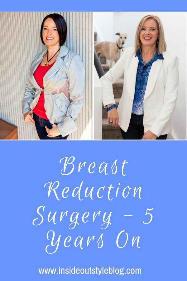 breast reduction surgery 5 years