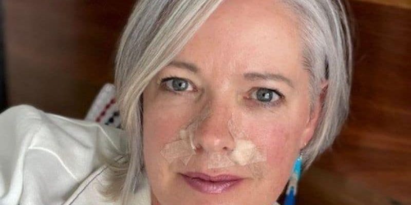 basal cell carcinoma skin cancer diagnosis And then this happened - after a trip to the dermatologist