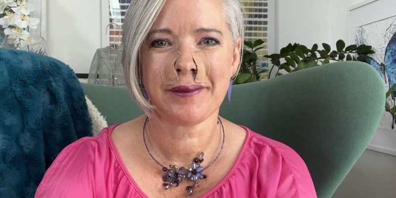 skin cancer update post op Post Operative Skin BCC Skin Cancer Update