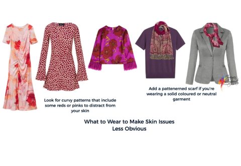 what to wear with skin issues what to wear with skin issues like acne and rosacea