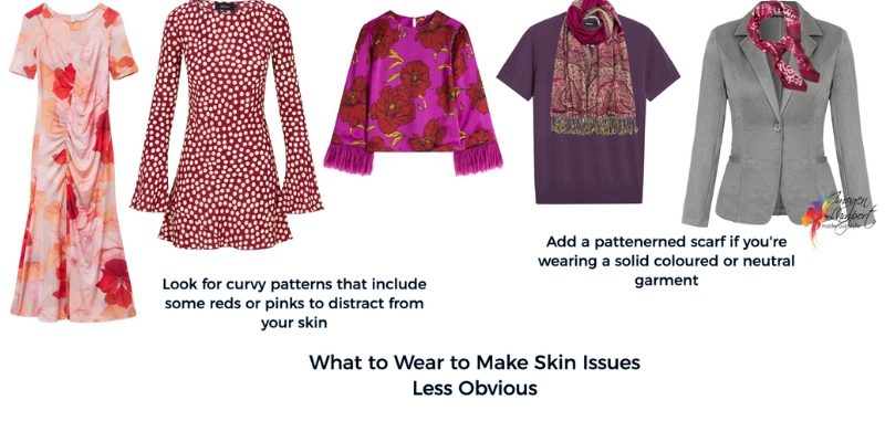 what to wear with skin issues like acne and rosacea